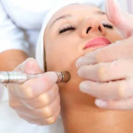 Microdermabrasion Package at Sweet Skinsations in Amarillo, TX