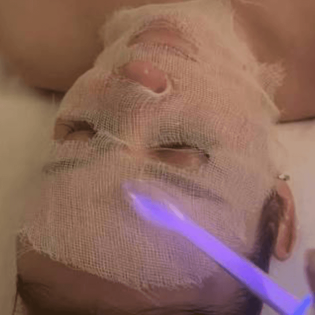 High Frequency Package at Sweet Skinsations in Amarillo, TX